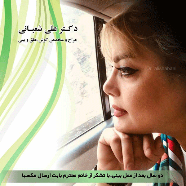 جراحی بینی استخوانی