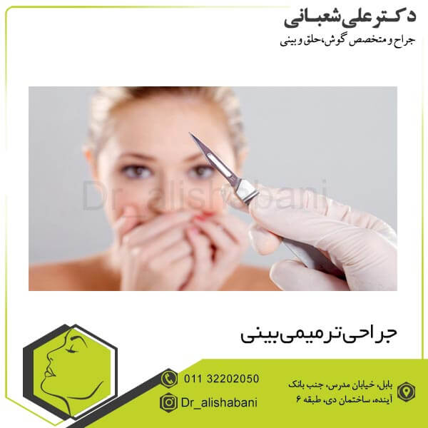 جراحی ترمیمی بینی - دکتر علی شعبانی بهترین جراح بینی بابل