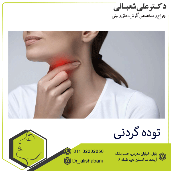 توده گردنی