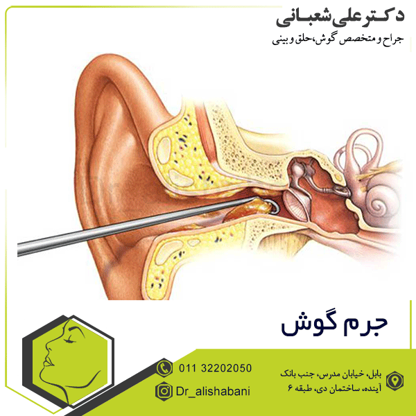 جرم گوش
