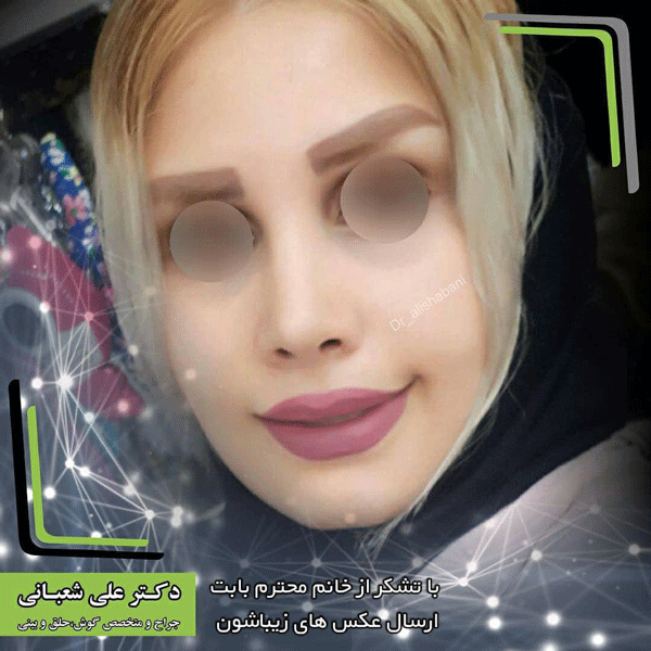 جراح بینی بابل