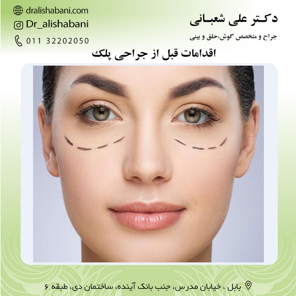 اقدامات قبل از جراحی پلک