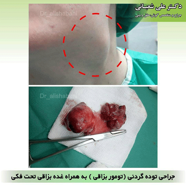 جراحی سر و گردن