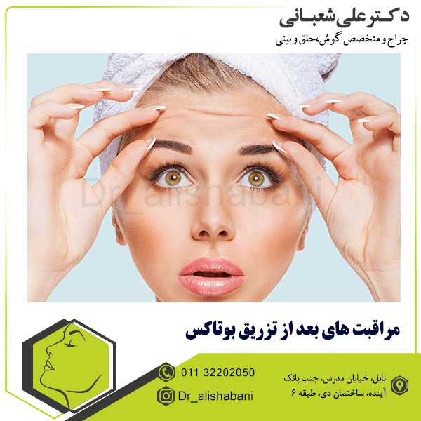 مراقبت های بعد از تزریق بوتاکس