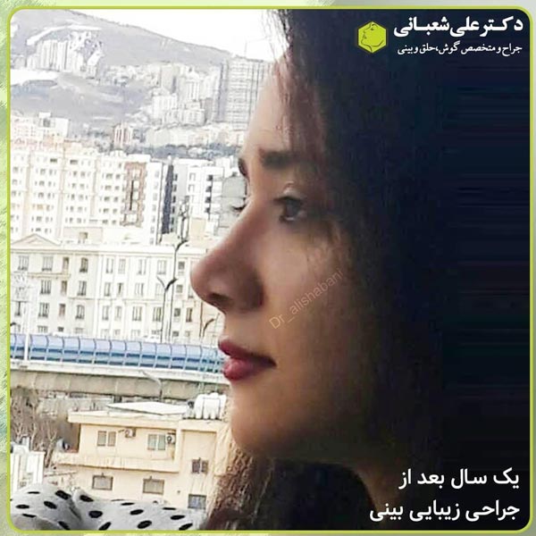 جراح بینی