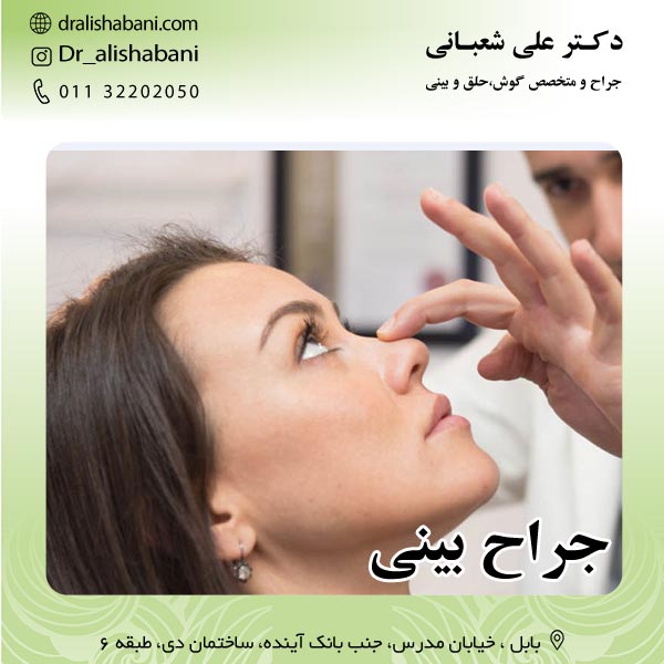 جراح بینی شمال