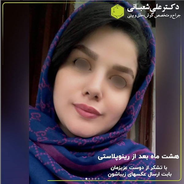 بهترین جراح بینی بابل