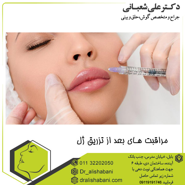 مراقبت های بعد از تزریق ژل