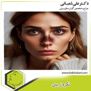 نکروز بینی - دکر علی شعبانی