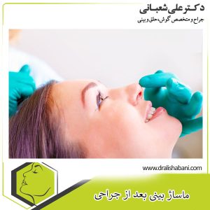 ماساژ بینی بعد از عمل _ دکتر علی شعبانی