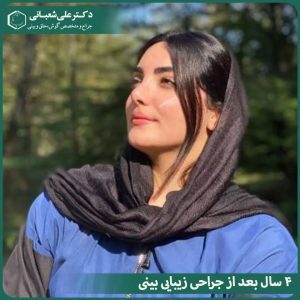 جراحی بینی استخوانی - دکتر علی شعبانی