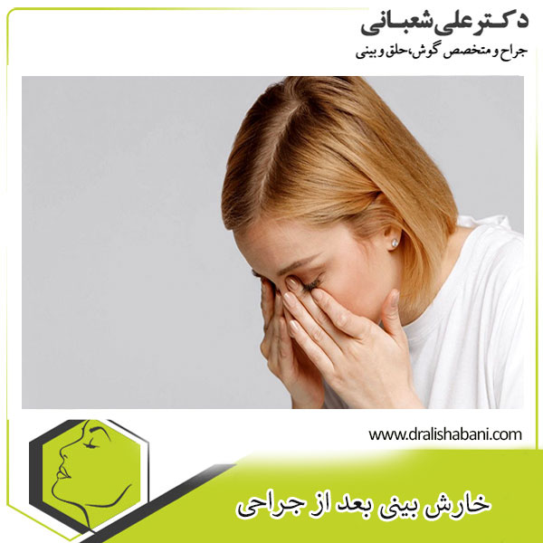 خارش بینی بعد از جراحی _ دکتر علی شعبانی