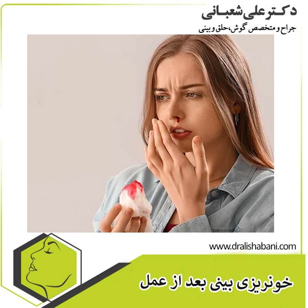 خونریزی بینی بعد از عمل