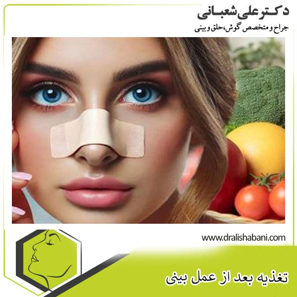 تغذیه بعد از عمل بینی - دکتر علی شعبانی