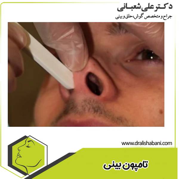 تامپون بینی