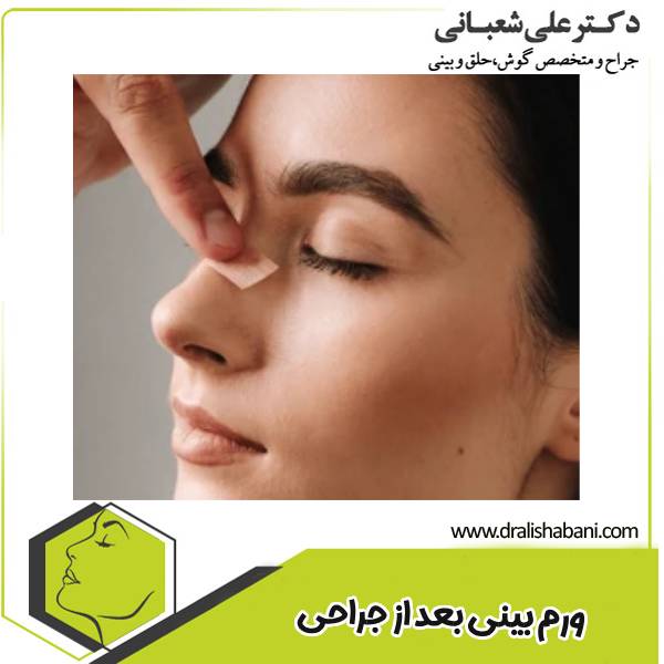 ورم بینی بعد از عمل