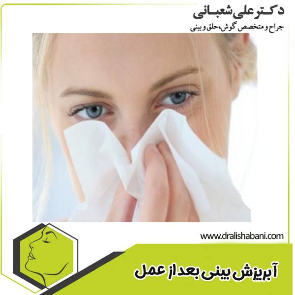 آبریزش بینی بعد از عمل