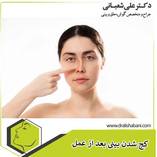 کج شدن بینی بعد از عمل | دکتر شعبانی