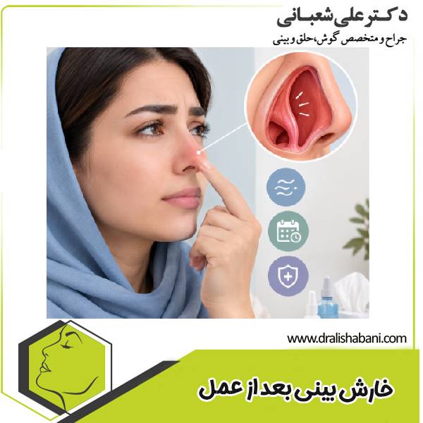 خارش بینی بعد از عمل بینی