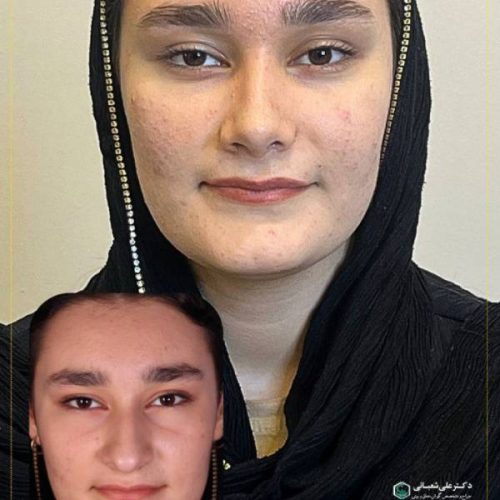 504جراحی-بینی-در-بابل
