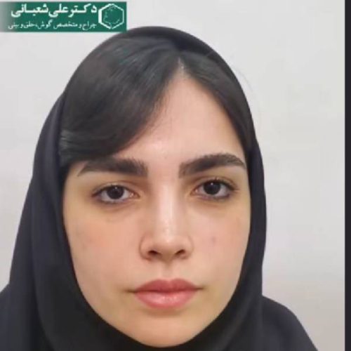 505جراحی-بینی-در-بابل