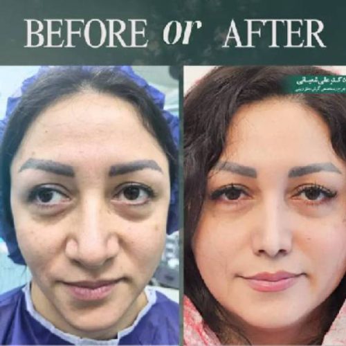 507جراحی-بینی-در-بابل