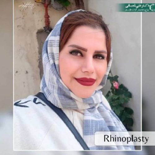 508جراحی-بینی-در-بابل