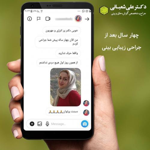 جراحی-بینی-در-بابل-124