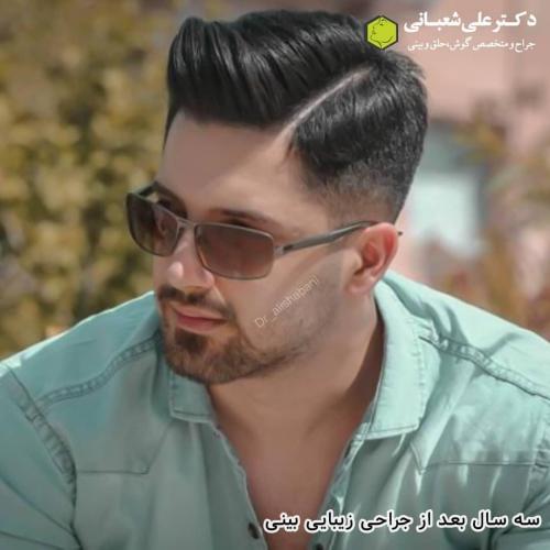 جراحی-بینی-در-بابل-146