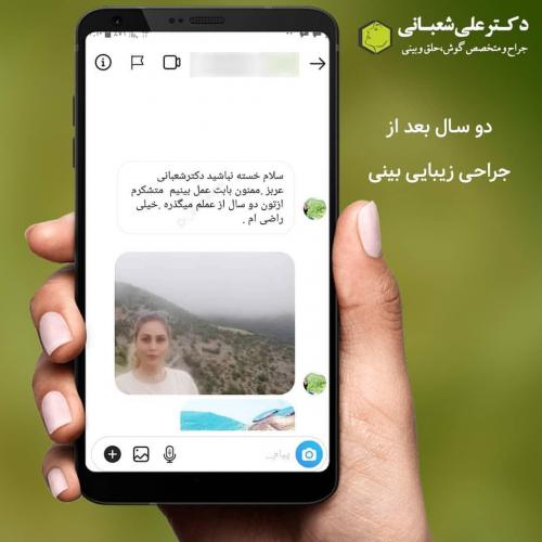جراحی-بینی-در-بابل-148