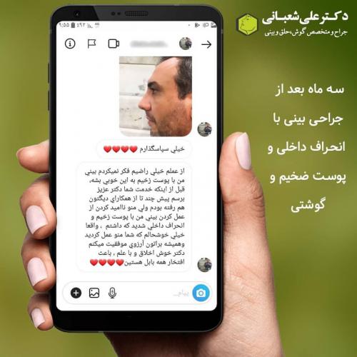 جراحی-بینی-در-بابل-165