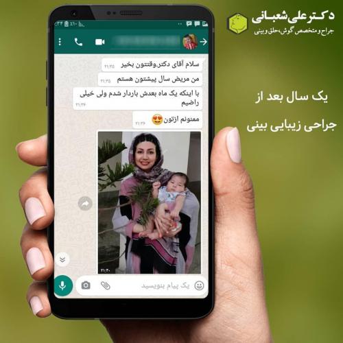 جراحی-بینی-در-بابل-170