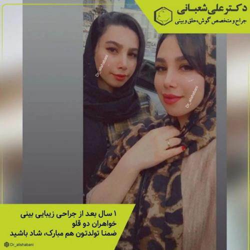 جراحی-بینی-در-بابل-413