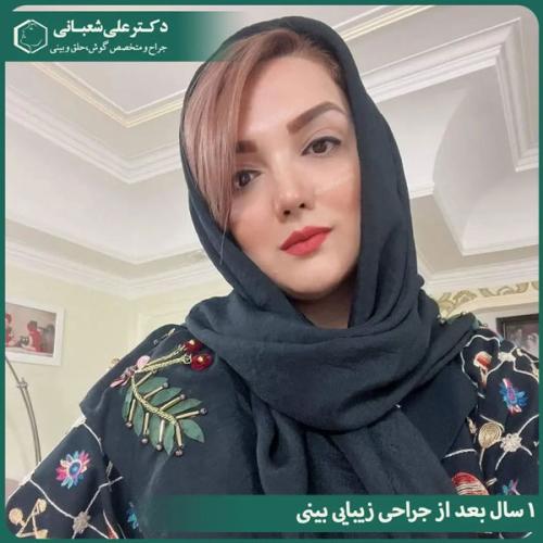 جراحی-بینی-در-بابل-478