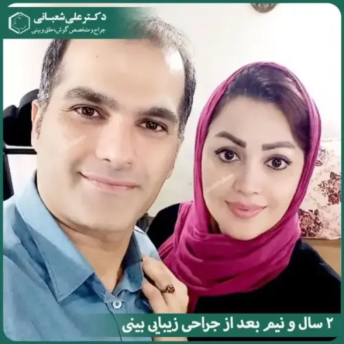 جراحی-بینی-در-بابل-483