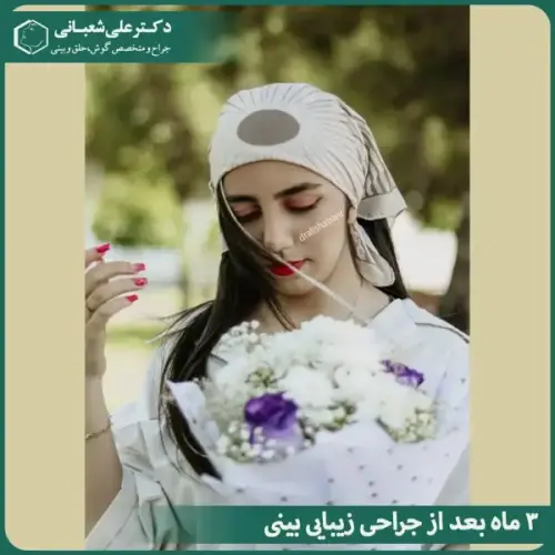 جراحی-بینی-در-بابل-485