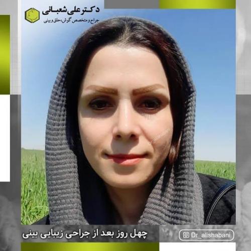 جراحی بینی 600 (145).jpg