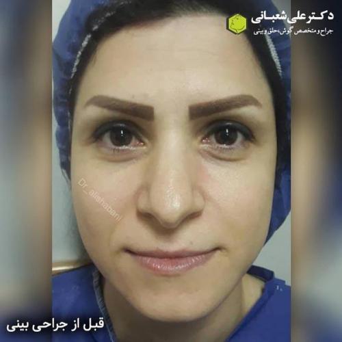 جراحی بینی 600 (146).jpg