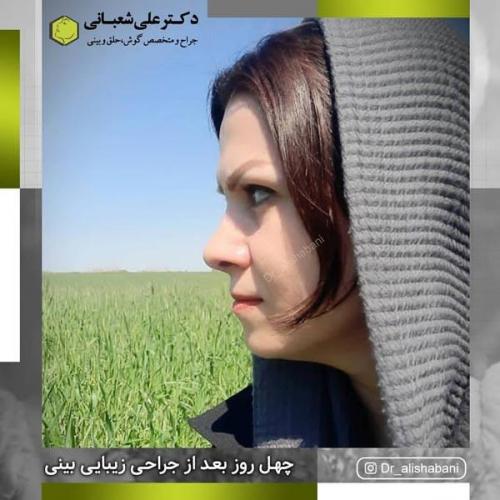 جراحی بینی 600 (147).jpg