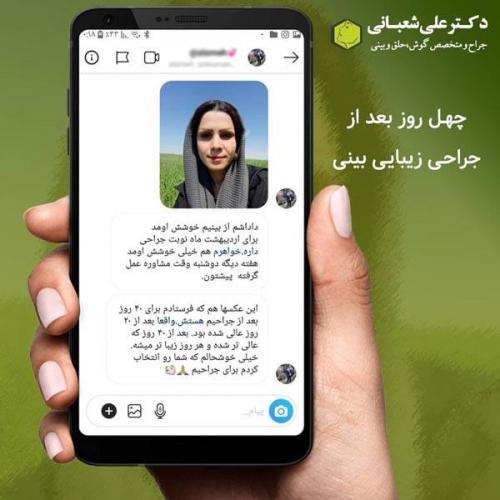 جراحی بینی 600 (149).jpg