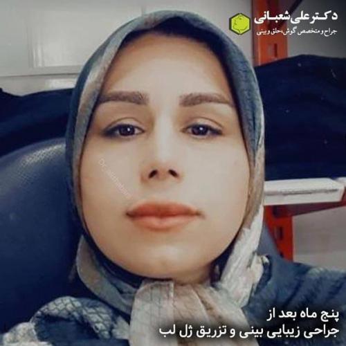 جراحی بینی 600 (166).jpg