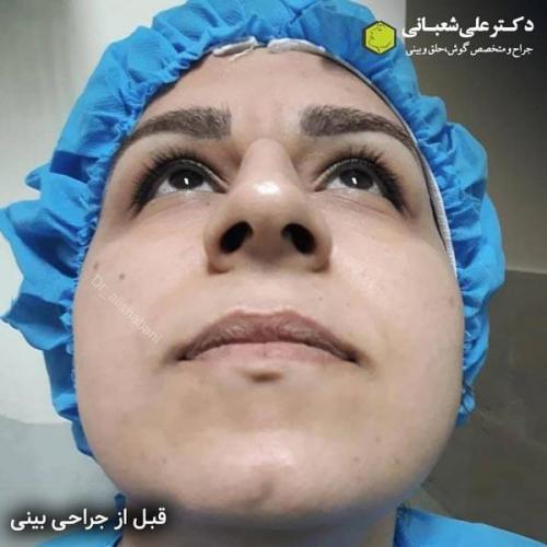 جراحی بینی 600 (167).jpg