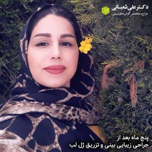 جراحی بینی 600 (168).jpg