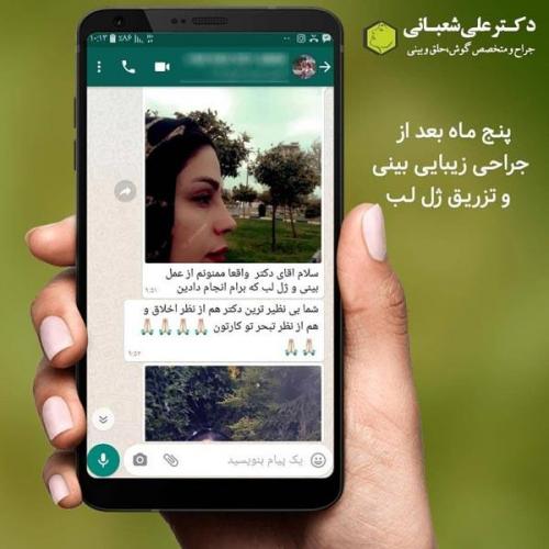 جراحی بینی 600 (169).jpg