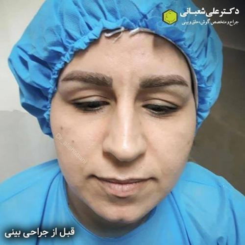جراحی بینی 600 (170).jpg