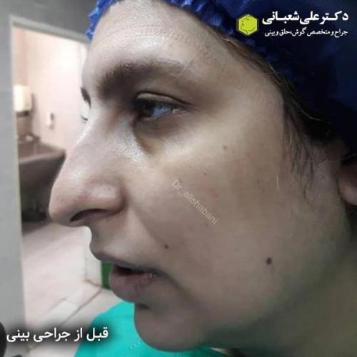 جراحی بینی 600 (172).jpg
