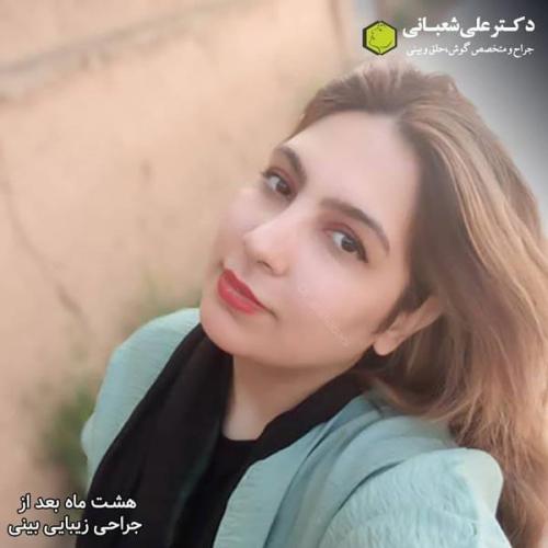 جراحی بینی 600 (173).jpg