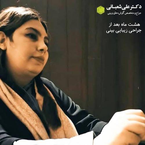 جراحی بینی 600 (176).jpg