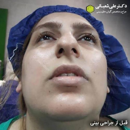جراحی بینی 600 (177).jpg