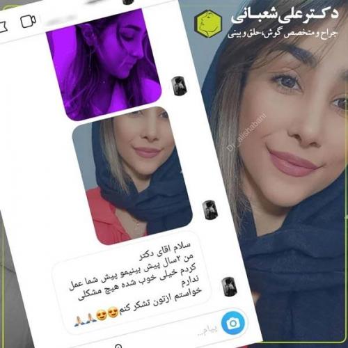 جراحی بینی 600 (192).jpg